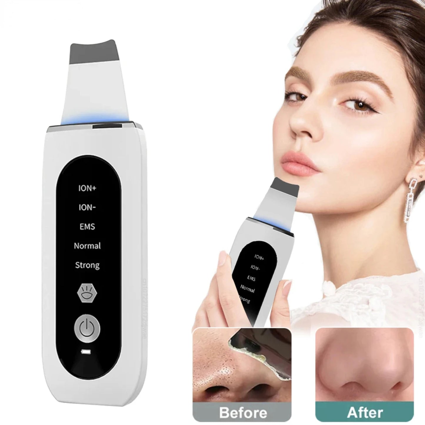 Ultrasonic Skin Scrubber – Deep Cleanse, Blackhead Removal & Skin Lifting for a Radiant, Youthful Glow