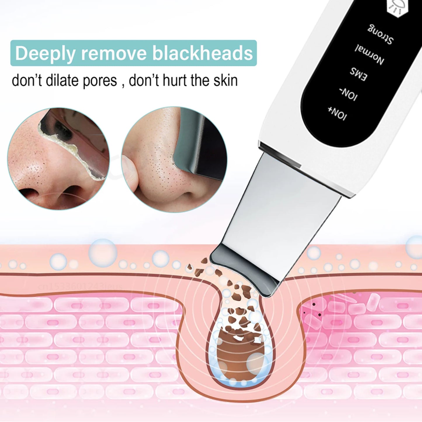 Ultrasonic Skin Scrubber – Deep Cleanse, Blackhead Removal & Skin Lifting for a Radiant, Youthful Glow