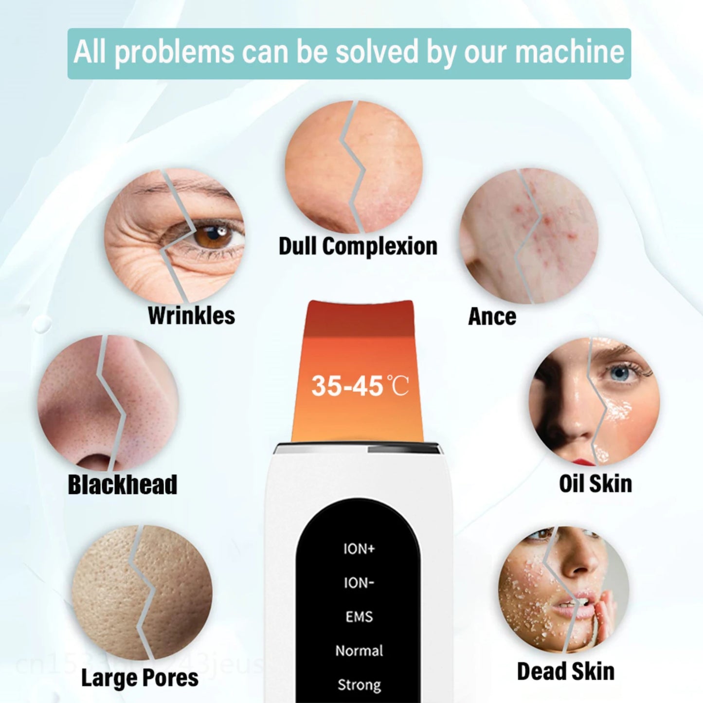 Ultrasonic Skin Scrubber – Deep Cleanse, Blackhead Removal & Skin Lifting for a Radiant, Youthful Glow